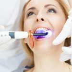 blanqueamiento dental dentista