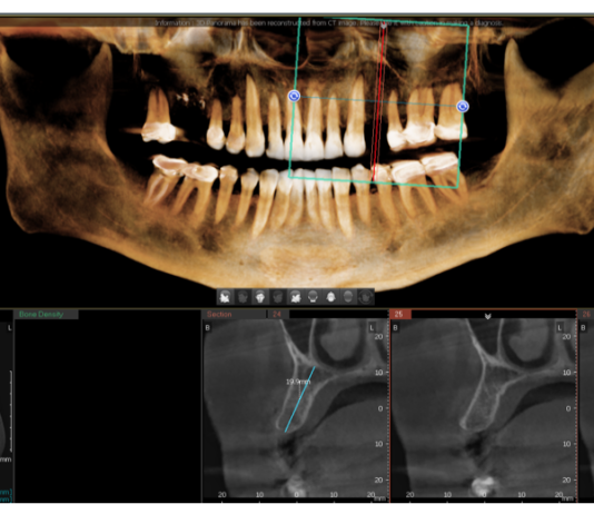 El flujo digital en el dentista