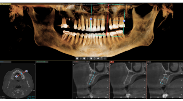 El flujo digital en el dentista
